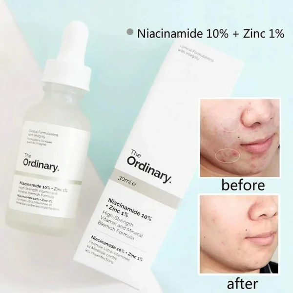 The Ordinary Niacinamide scrum